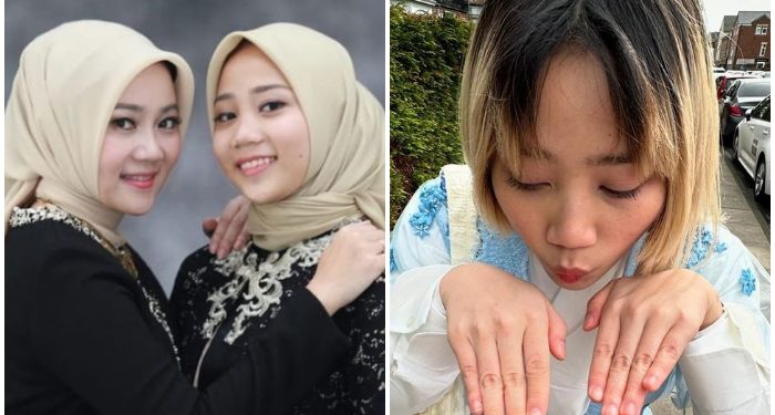 Lihat Zara Gerai Rambutnya, Ini Tanggapan sang Ibu Atalia Kamil