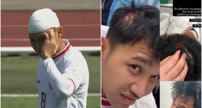 Waduh, Istrinya Sebut Kepala Witan Sulaeman Pecah! Main Hingga Akhir Vs Guinea Walau Kepala Bocor