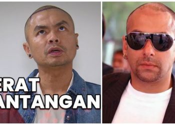 Ogah Botak Terus, Wendy Cagur Putuskan Transplantasi Rambut, Satu Helai 30 ribu, Belum Termasuk Obatnya!