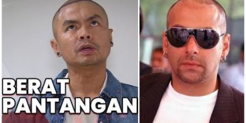 Ogah Botak Terus, Wendy Cagur Putuskan Transplantasi Rambut, Satu Helai 30 ribu, Belum Termasuk Obatnya!