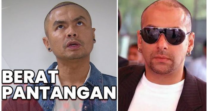 Ogah Botak Terus, Wendy Cagur Putuskan Transplantasi Rambut, Satu Helai 30 ribu, Belum Termasuk Obatnya!