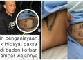 Sadisnya Taufik Hidayat, Bikin Hancur Wajah Yuvita, Juga Tato’i Sekujur Tubuh Kekasihnya