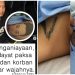 Sadisnya Taufik Hidayat, Bikin Hancur Wajah Yuvita, Juga Tato’i Sekujur Tubuh Kekasihnya