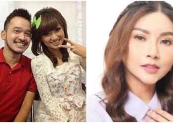 Ruben Onsu Tak Berdaya dengan Sarwendah, Sampai Nekat Oplas Tak Gubris Larangan Suami!